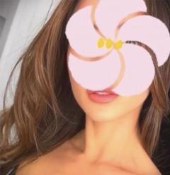 Erotic Escort Massage – Today's photo of Milla(32) Photo141685