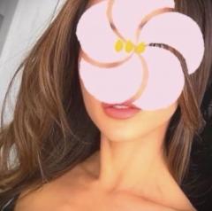 Erotic Escort Massage – Today's photo of Milla(36) Photo143369